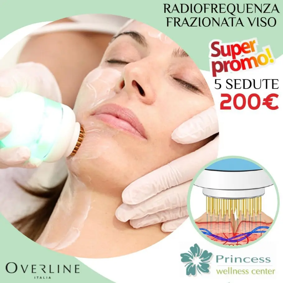 Radiofrequenza frazionata viso SUPER PROMO | Centro Estetico Wellness Nocera